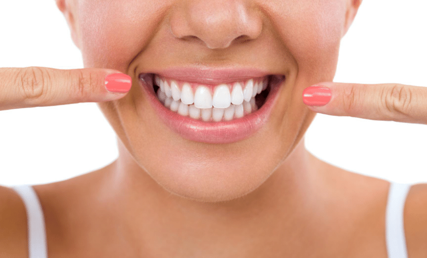 cómo mantener tu blanqueamiento dental más tiempo